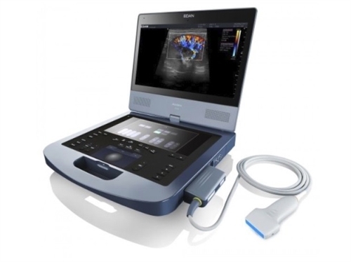 edan ultrasound review